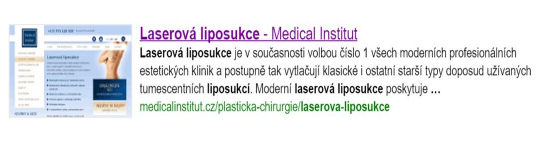 Liposukce v Plzni - MEDICAL INSTITUT Plzeň