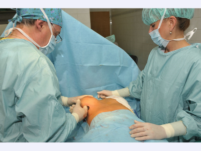 plastická chirurgie - zvětšení prsou pomocí prsních implantátů 
